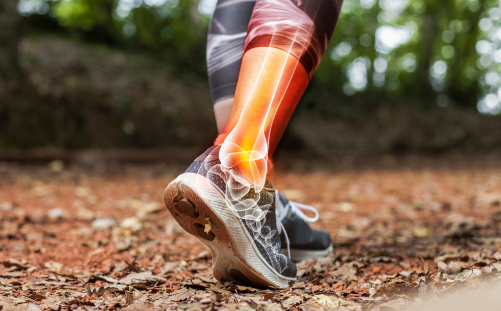 Sports injury